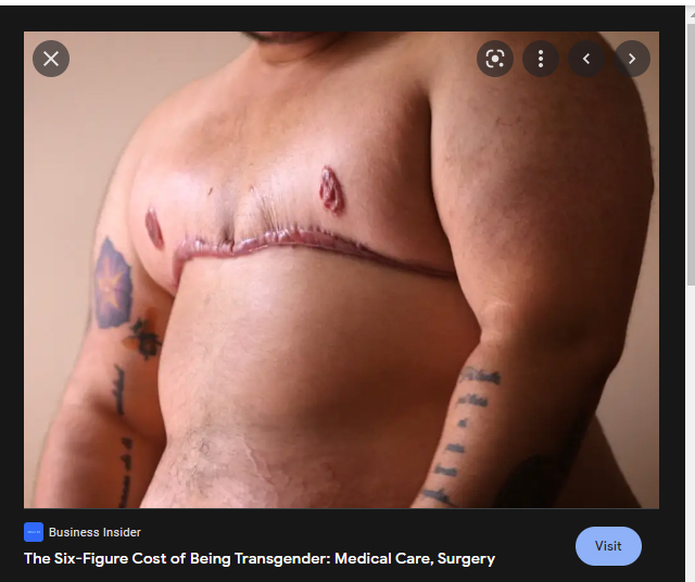 scarred chest.jpg