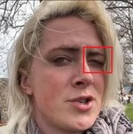 JordansLeftEyeClosed02.jpg JordansLeftEyeClosed02.jpg