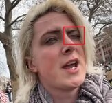 JordansLeftEyeClosed01.jpg JordansLeftEyeClosed01.jpg