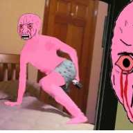 Extreme Aneurysm
