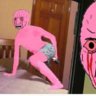 Extreme Aneurysm